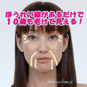 ほうれい線で老けて見える